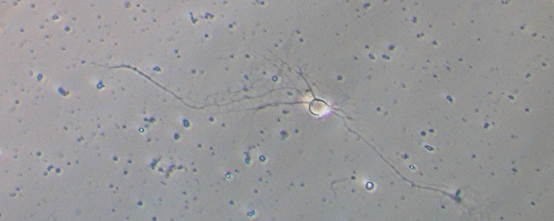 Bild aus der Forschung